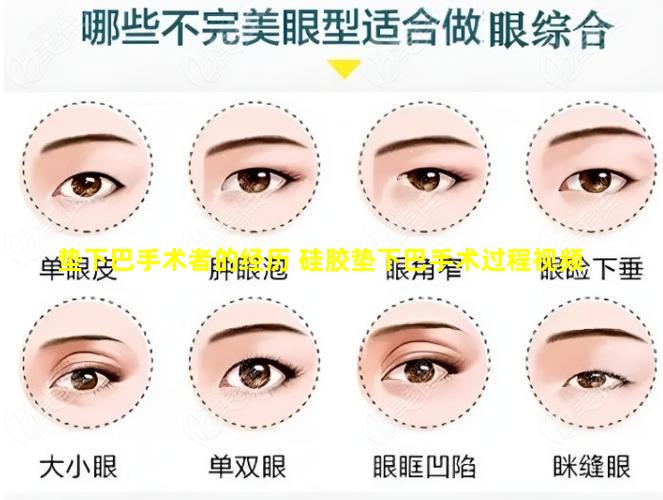 垫下巴手术者的经历 硅胶垫下巴手术过程视频